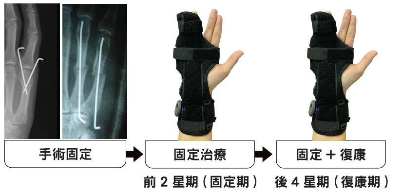 Surgical treatment flow